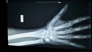 Pyr&eacute;n&eacute;es Circus partie 2 : la jeunesse est chaude.